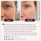Glowé® 7-in-1 LED Facial Sculptor