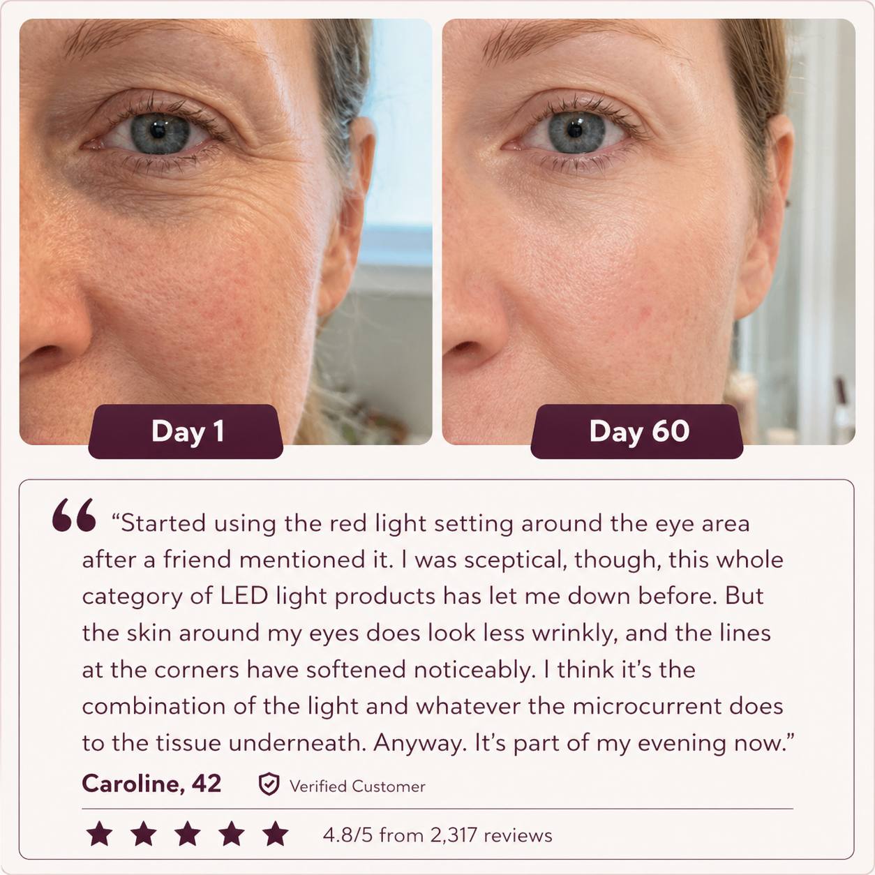 Glowé® 7-in-1 LED Facial Sculptor