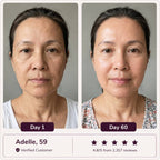 Glowé® 7-in-1 LED Face Mask
