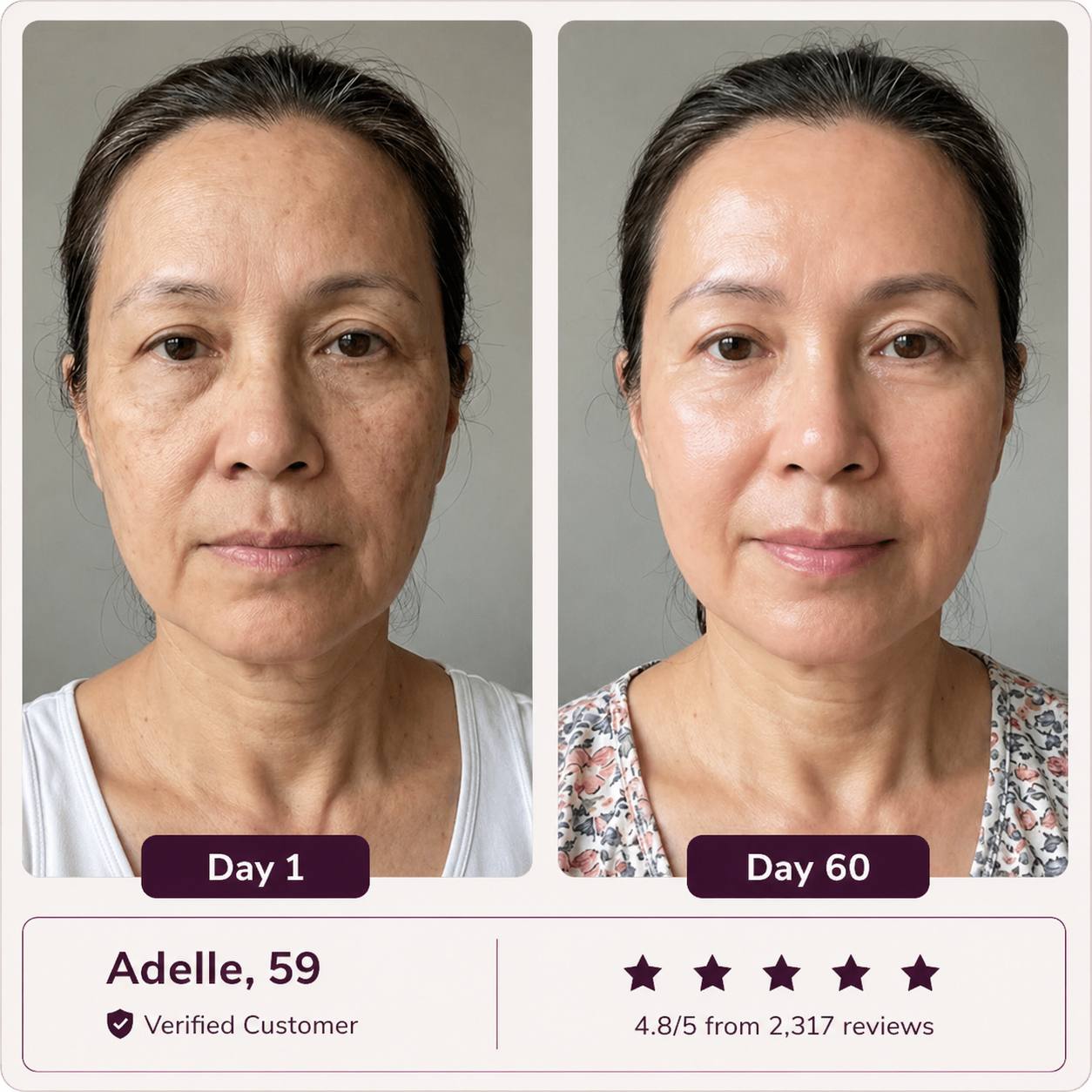 Glowé® 7-in-1 LED Face Mask