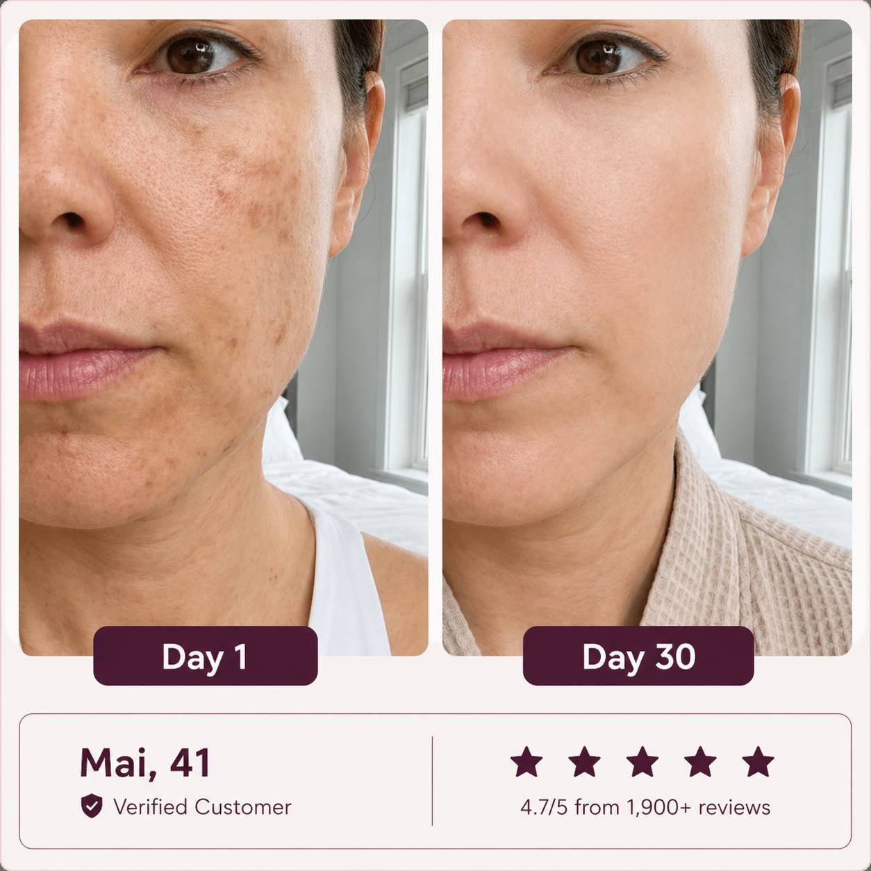 Glowé® 7-in-1 LED Face Mask