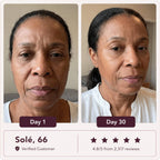 Glowé® 7-in-1 LED Face Mask