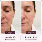 Glowé® 7-in-1 LED Face Mask