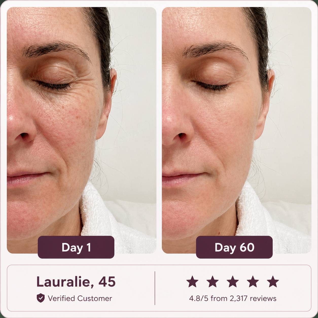Glowé® 7-in-1 LED Face Mask