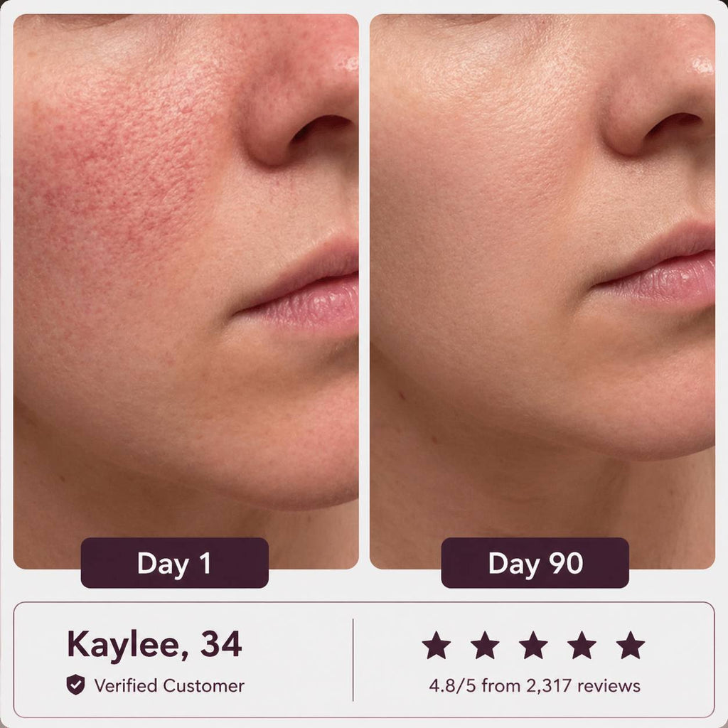 Glowé® 7-in-1 LED Face Mask