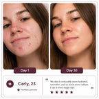 Glowé® Overnight Collagen Mask